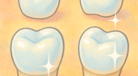 歯のクラウンの美しい輝き