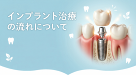 インプラント治療のイメージ